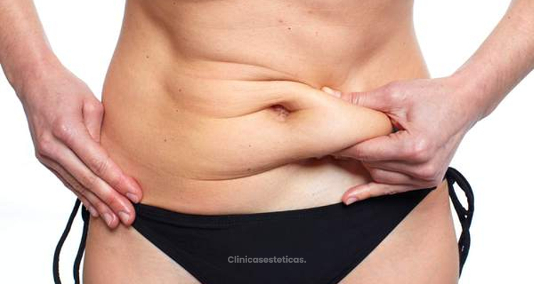 Como eliminar hongos en el abdomen